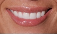 Jamaca Smiles Dental, PLLC in Jamaica NY